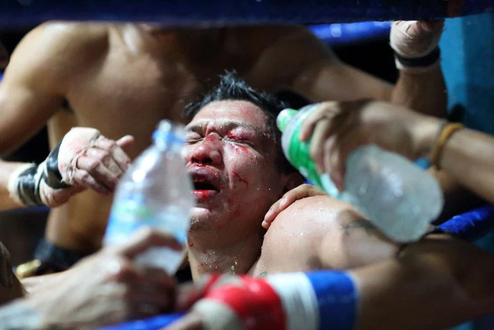 How to avoid injuries in Muay Thai and Combat Sports 2026