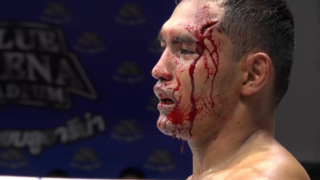 How bad is Head Trauma in Combat Sports? 2026